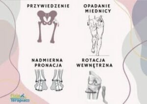 Itbs: zespół tarcia pasma biodrowo-piszczelowego — przyczyny, objawy i leczenie